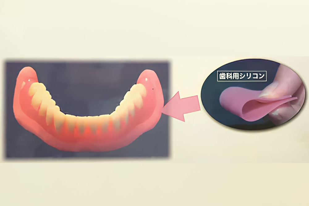 ピタットン（ゴムタイプデンチャー）