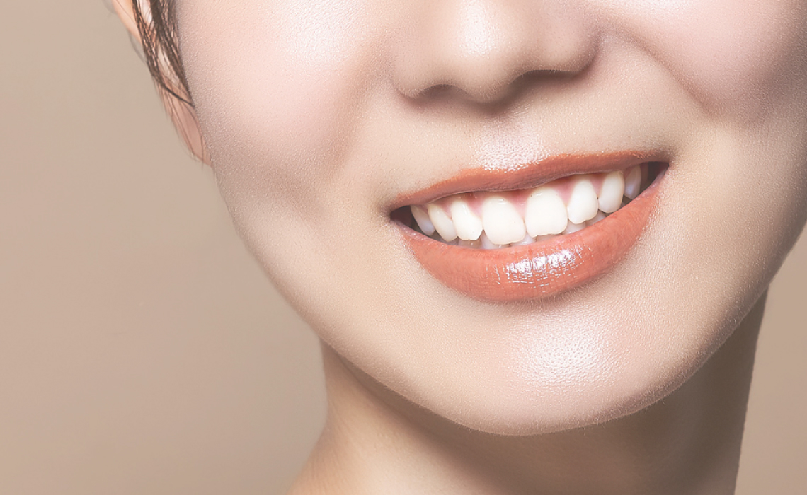 ホワイトニング